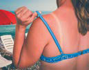 Sunscreen is great start to skin protection